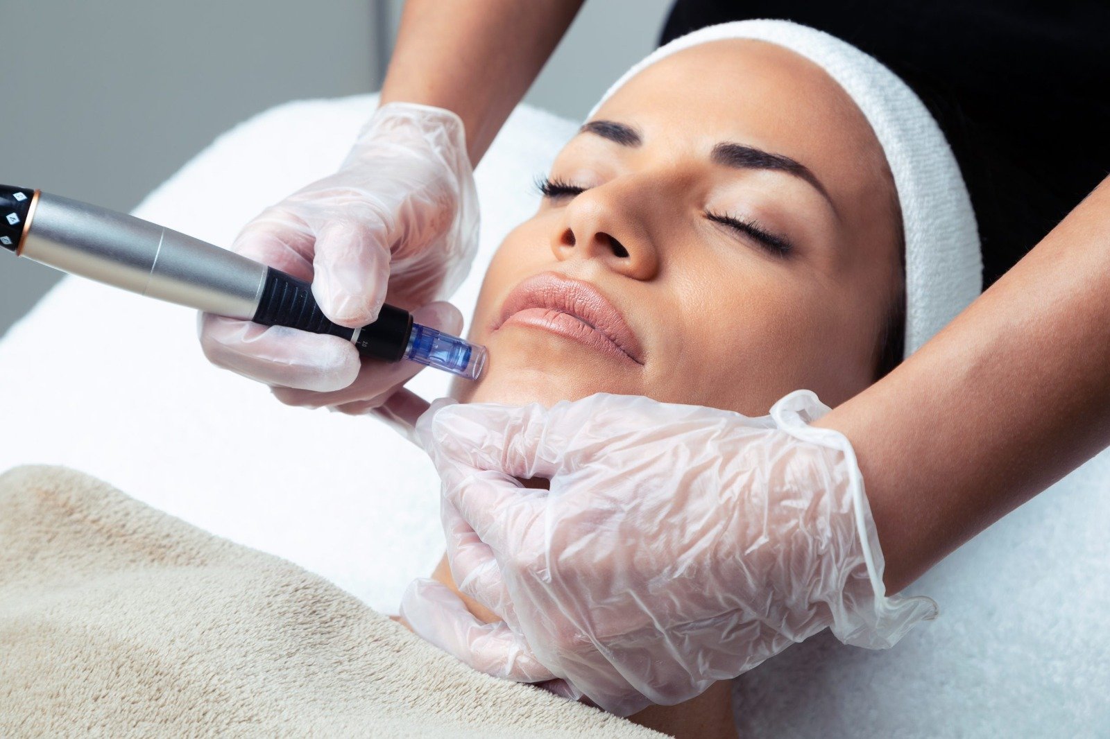 Collagen Induction Therapy